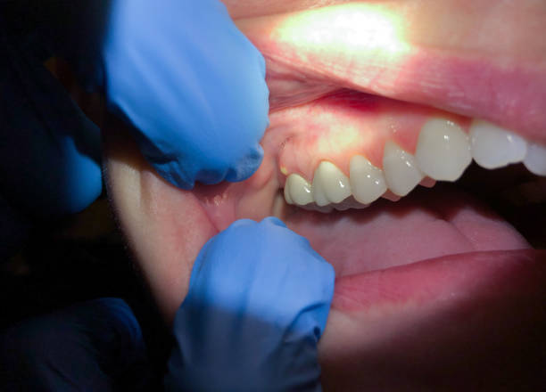 Best Pediatric Emergency Dentist in Brushy Creek, TX