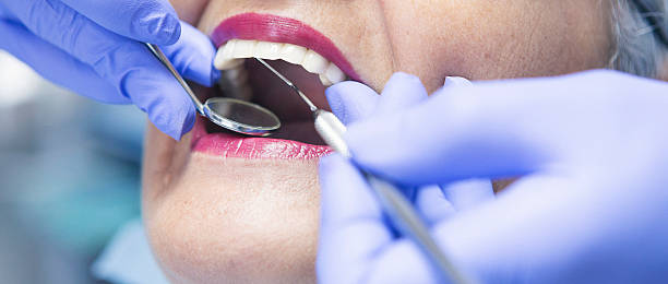 Best Emergency Root Canal Treatment in Brushy Creek, TX